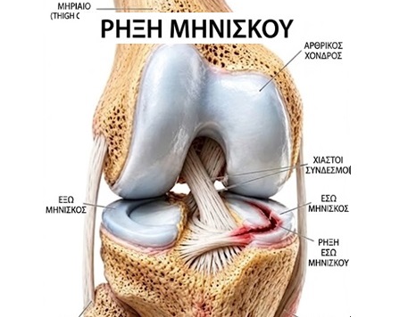 Rixi Miniskou2