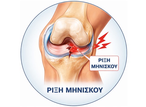 Rixi miniskou3 Rixi miniskou3
