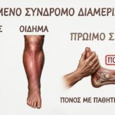 Diamerisma