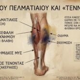 Tennis leg